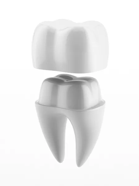Discover the Future of Dental Crowns with Innovations That Will Transform Your Smile