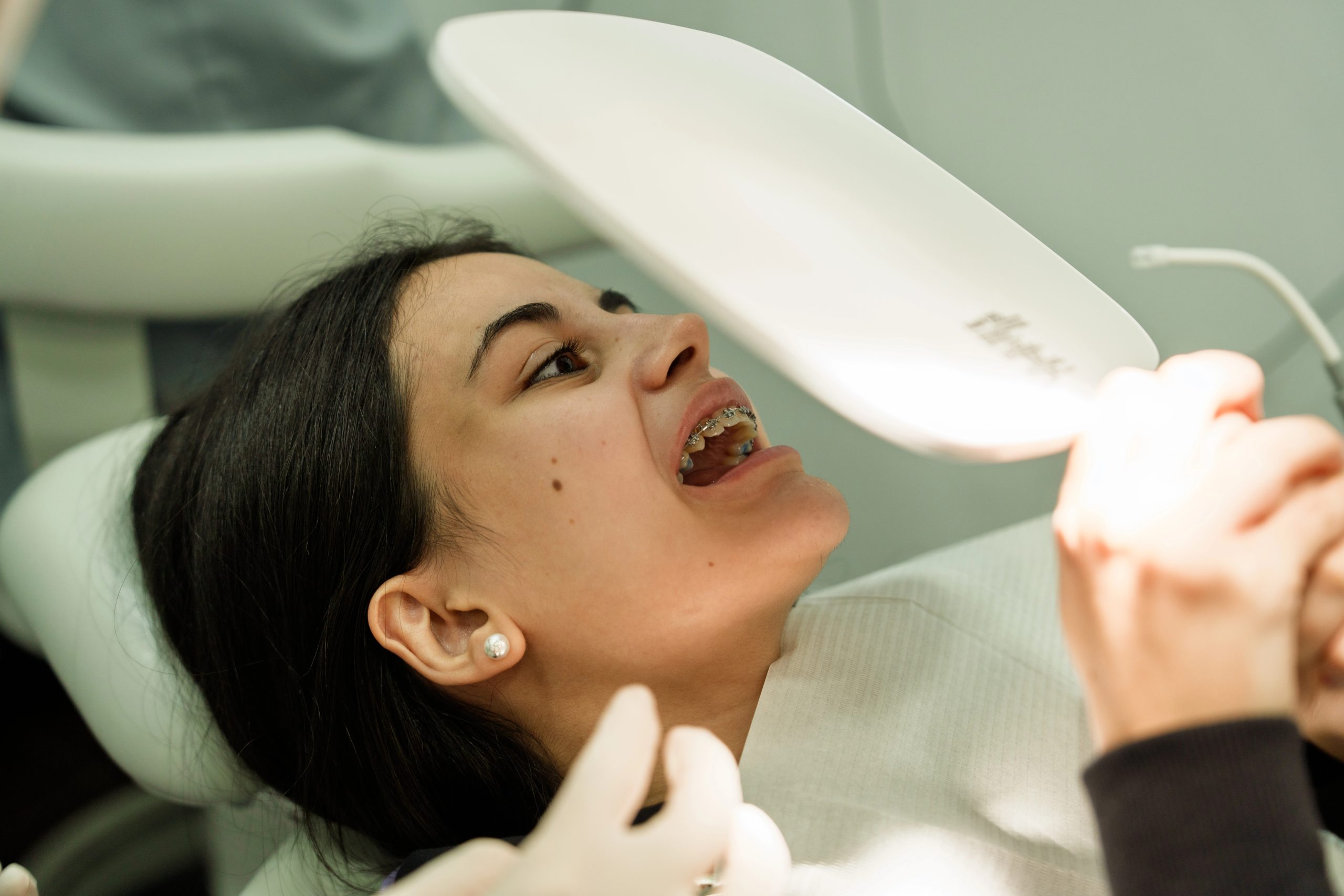 Are Dental Sealants the Right Choice for Your Family’s Cavity Prevention?